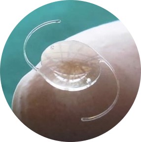 clear lens replacement