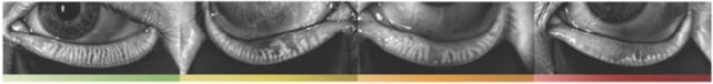 eyelid-glands