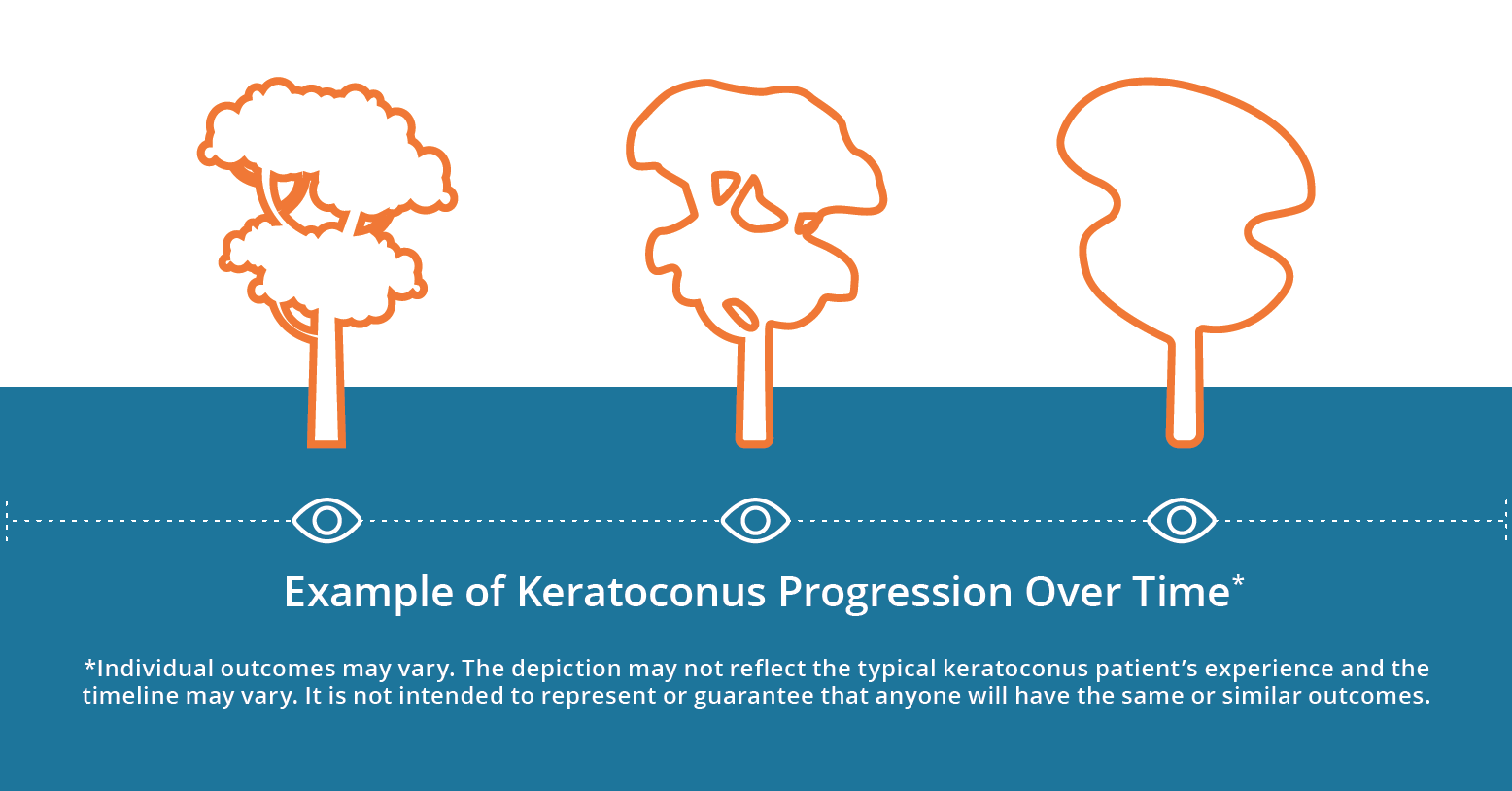 Keratoconus Early Detection