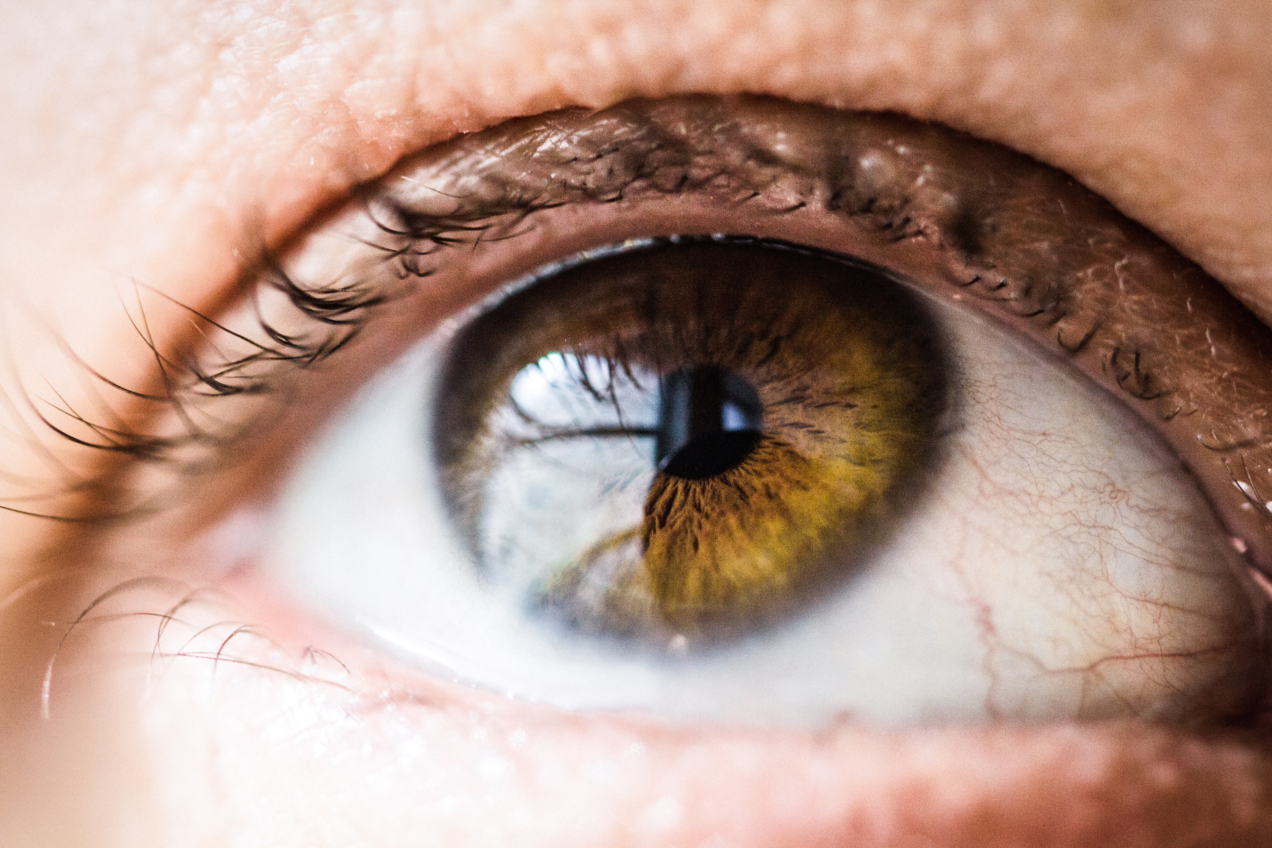 Common causes and treatments for red, bloodshot eyes