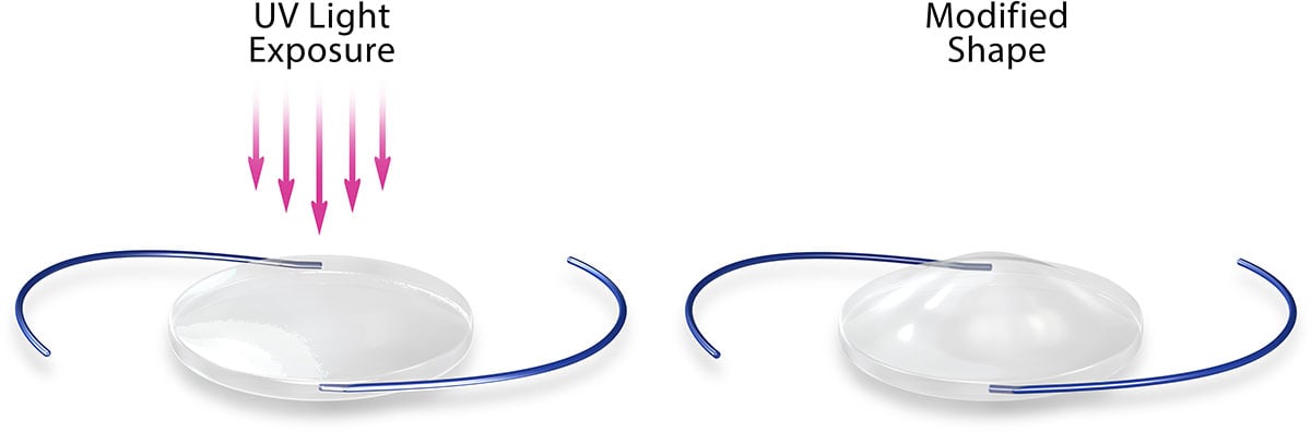 The newest cataract lens available