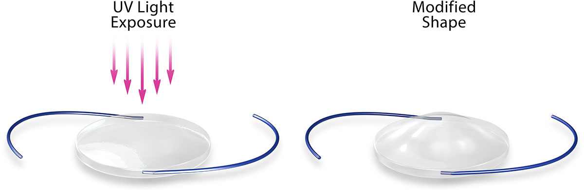 The newest cataract lens available