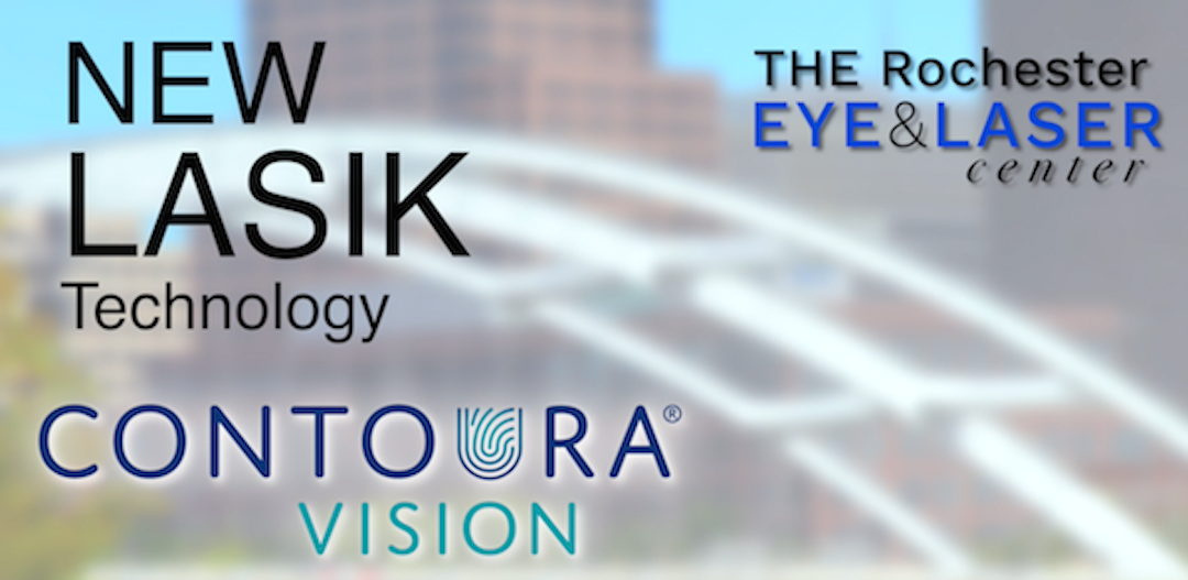 Is LASIK right for you?